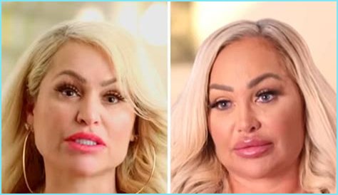 Darcey and Stacey Silva share footage as they undergo their latest cosmetic treatments